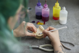 Gerade Zähne mit FRECH KIEFERORTHOPÄDIE in Mosbach